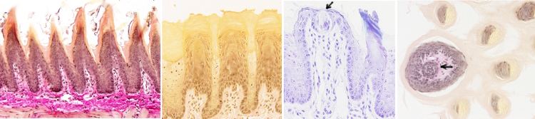 Papillae