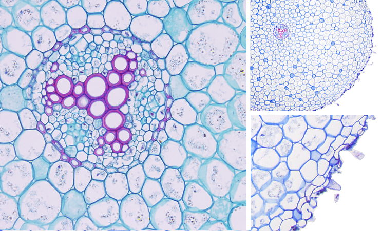 Primary growth. Dicot.