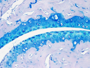 Articular cartilage