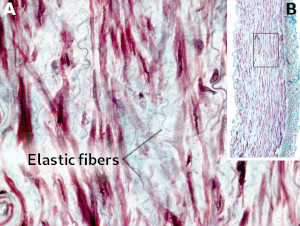 Elastic fibers