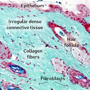 Irregular dense connective