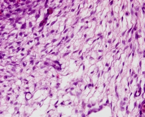 Mesenchymal connective