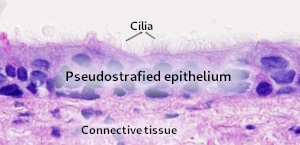 Pseudostrafied epithelium