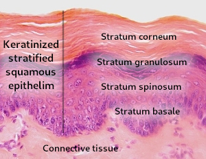 Keratinized stratified squamous epithelum