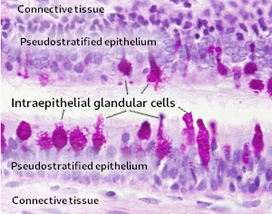 Intraepithelial gland