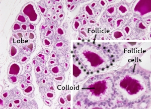 Thyroid