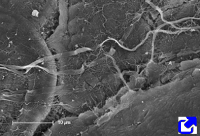 Collagen fibers