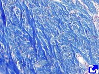 Dermal collagen