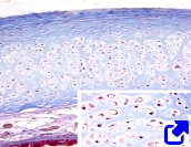 Hyaline cartilage