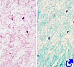 Gelatinous connective