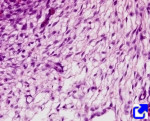 Mesenchymal connective