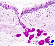 Exocrine gland