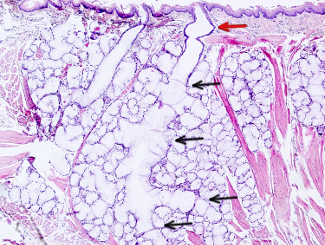 Sublingual salivary gland