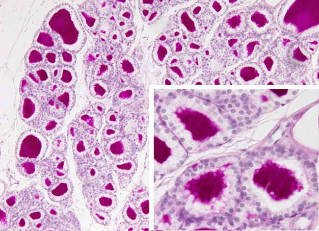 Epithelium: thyroid  gland