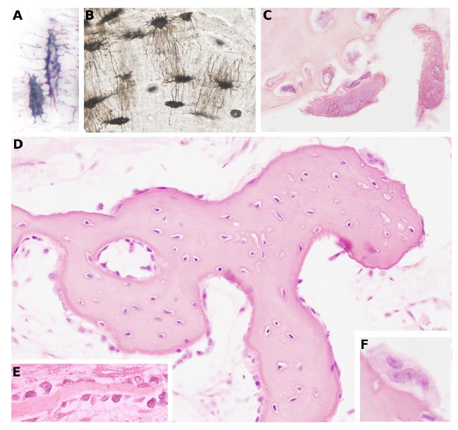 Osteocytes