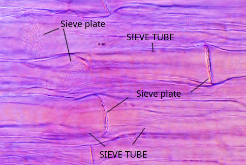 Sieve plates