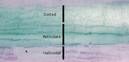 Metaxylem