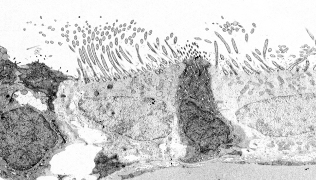 Transmissie-elektronenmicroscopiebeelden van cilia