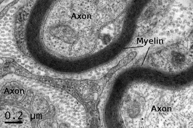 Строма кишечника. Миелин под микроскопом. Animal Tissue. Строма в строме фолликулов с диаметром 9 мм. Белки миелина.