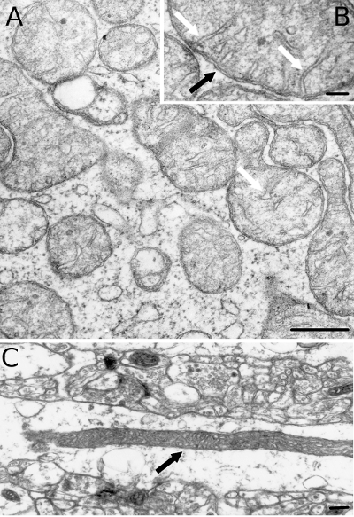 plant cell mitochondria microscope