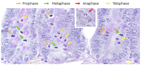 stages of mitosis in animal cells