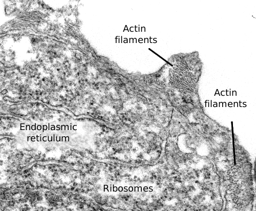 microfilaments electron microscopy