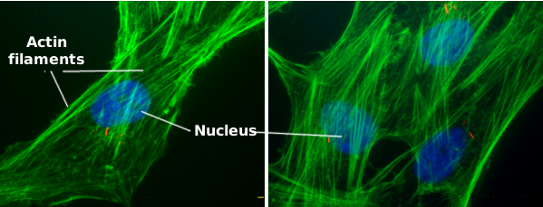 microfilaments in a plant cell