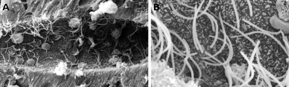 Imagini de microscopie electronică cu baleiaj ale cililor