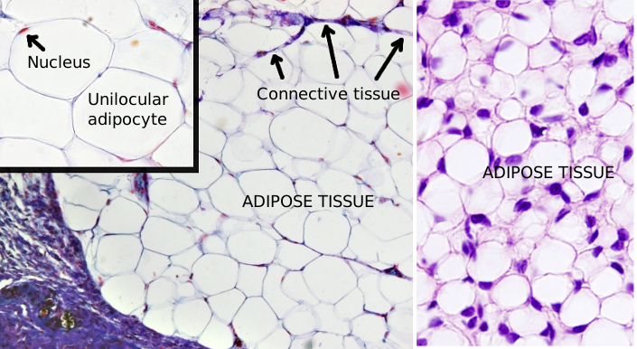 adipose tissue with adipocytes