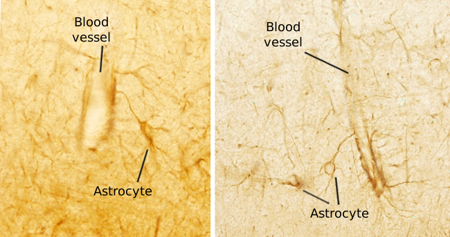 astrocyte histology