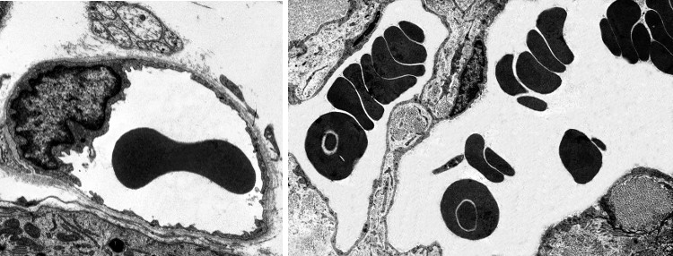 Erythrocytes