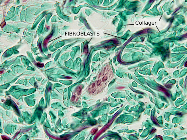 Fibroblasts