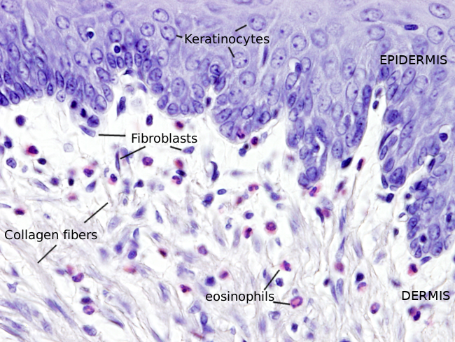 Fibroblasts In Connective Tissue