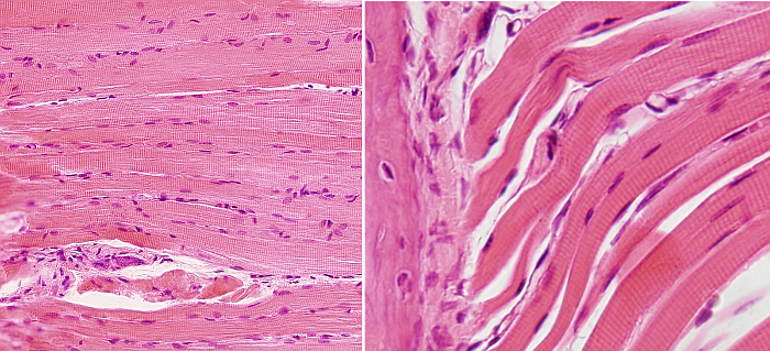 Skeletal muscle