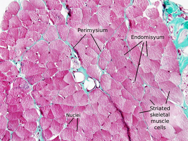 skeletal muscle histology labeled