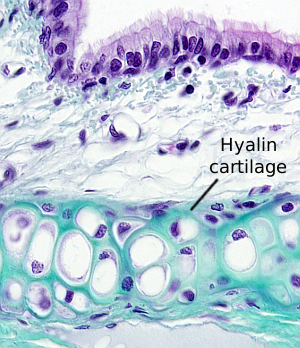 hyaline cartilage connective tissue trachea