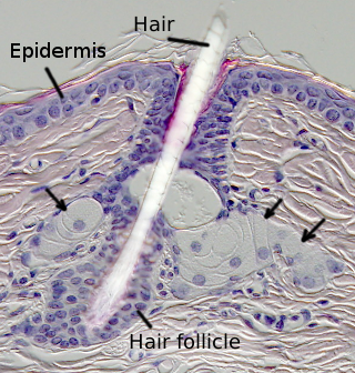 Sebaceous gland