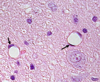 Endothelium