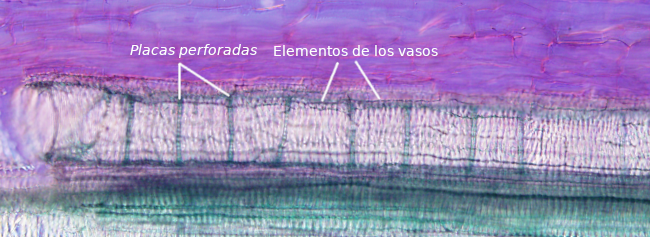 Metaxilema