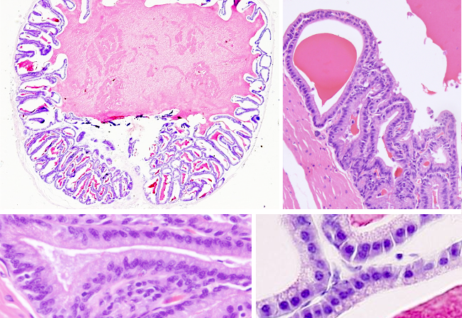 Seminal vesicle