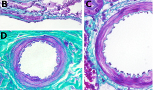 Arteriola