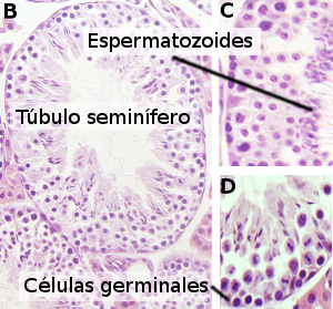 Túbulos seminíferos