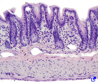 Intestino grueso