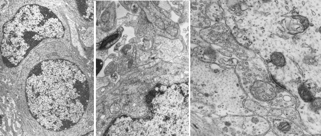 microscopio electrónico de células animales etiquetados