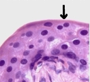 Binucleated cells