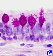 Intraepithelial gland