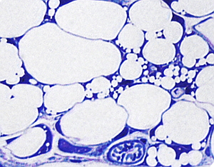 Adipocytes blancs