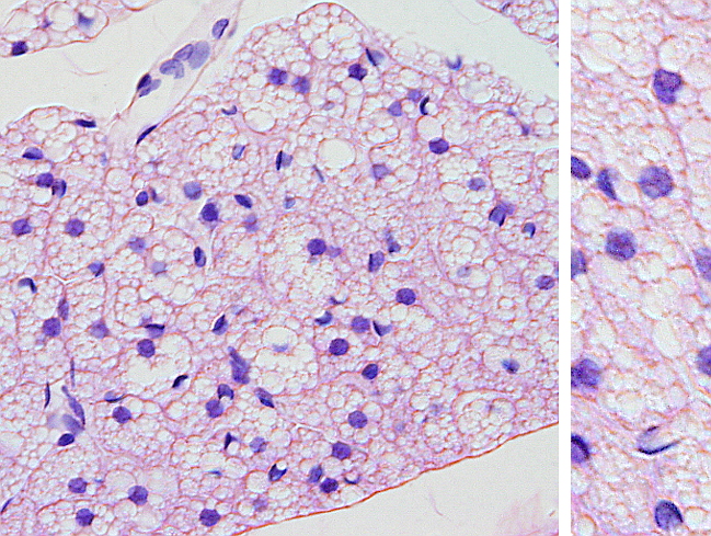 brown adipose connective tissue