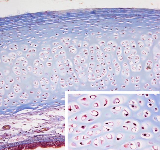 hyaline cartilage connective tissue slide