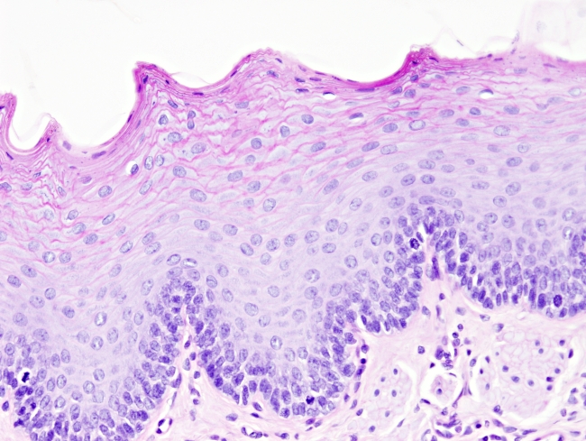 Epithelium: stratified squamous